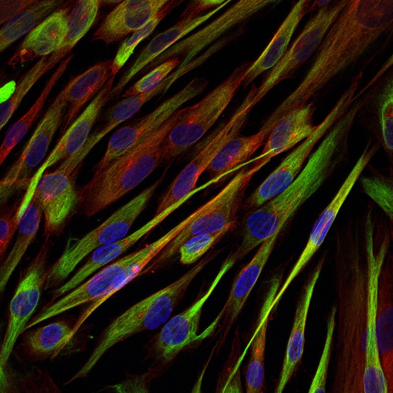 DPSC stem cells under fluorescence microscopy