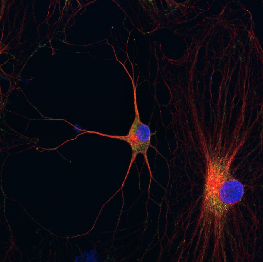 DPSC-derived neurons showing dendritic morphology